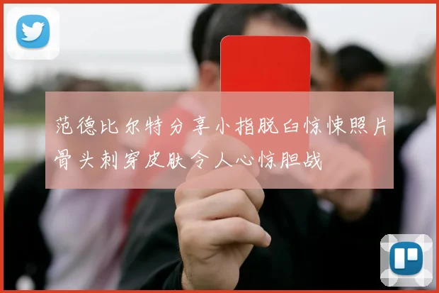 范德比尔特分享小指脱臼惊悚照片骨头刺穿皮肤令人心惊胆战